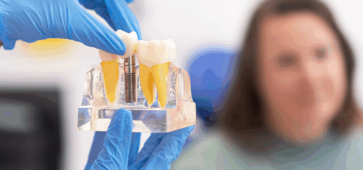 Dental Implant