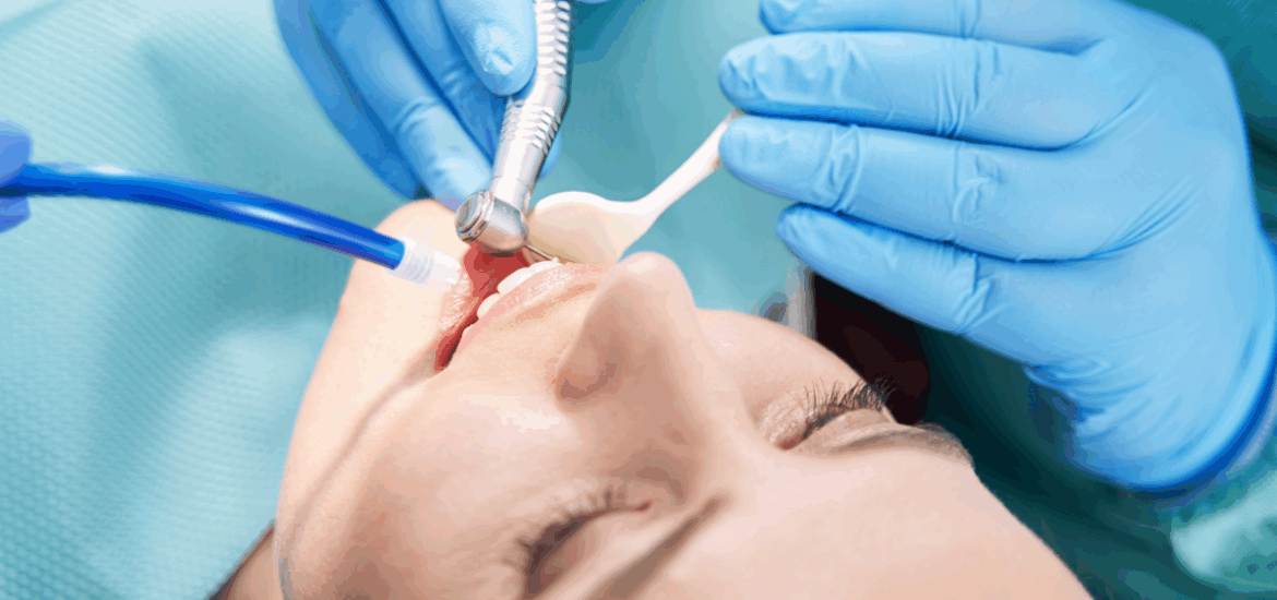 Root Canal Treatment