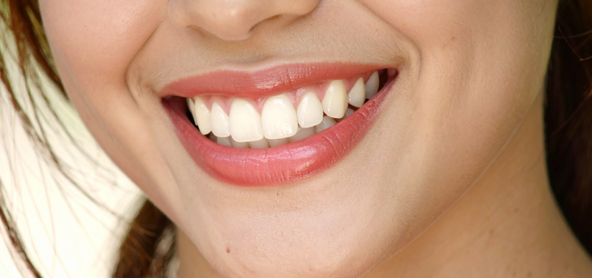 Close-up of smiling woman displaying bright, healthy white teeth and natural smile.