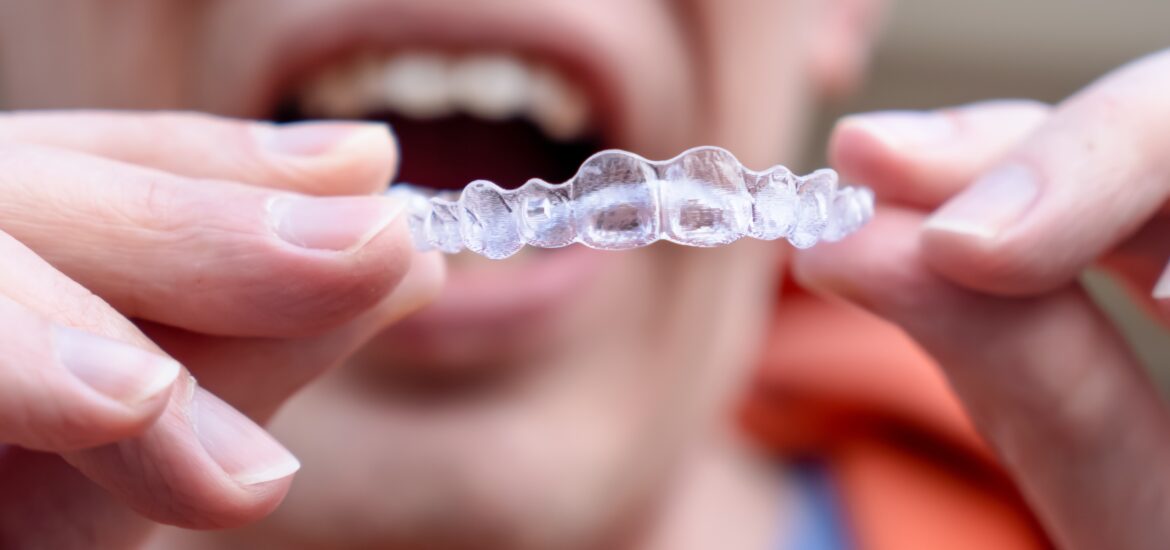 Invisalign