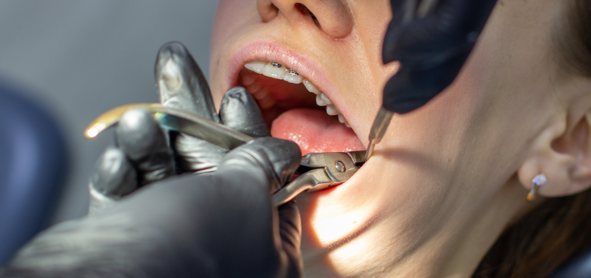 Emergency Dentist in Scottsdale